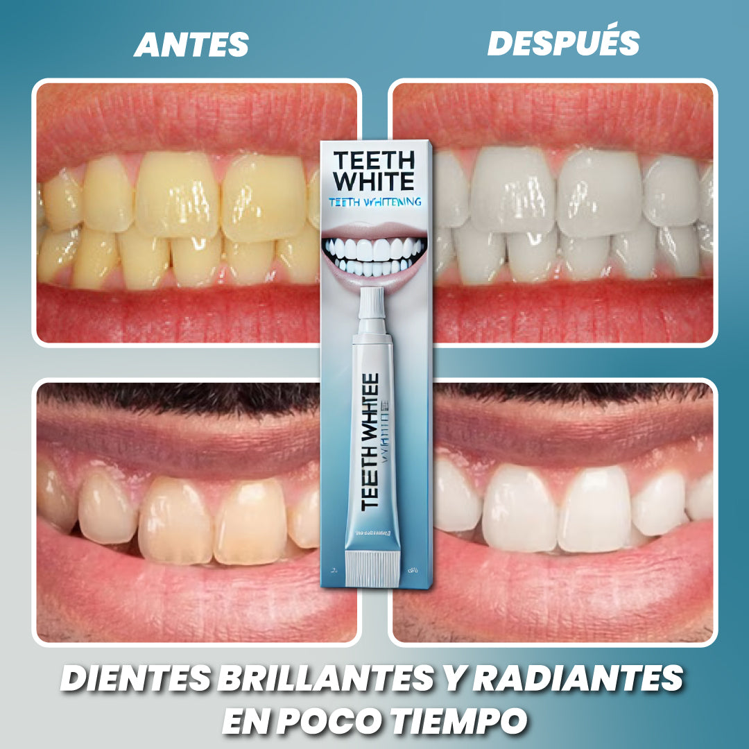 Blanqueador dental - Teeth White™