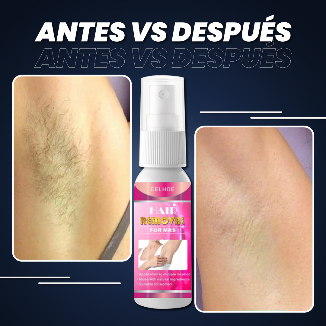 Spray depilatorio - Hair Removal™